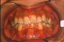ortodontics (22025 byte)