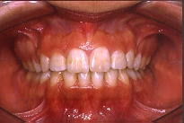 ortodonzia (21647 byte)