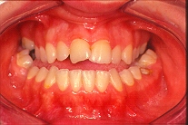 ortodonzia (23702 byte)