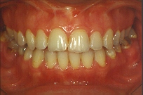 ortodontics (19015 byte)