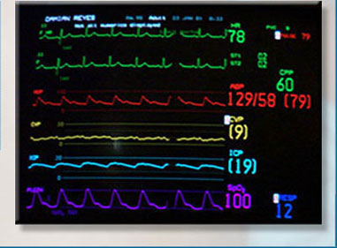 Anesthesia monitor